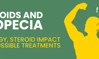 Steroids and Alopecia
