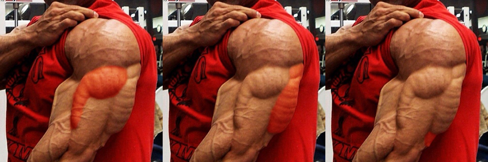 Best%20Triceps%20Exercise