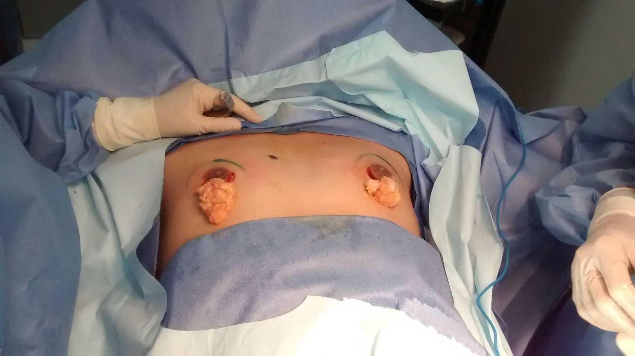 ac5c7f2a1de94f5d14fcf1544d671b9f23185b2a